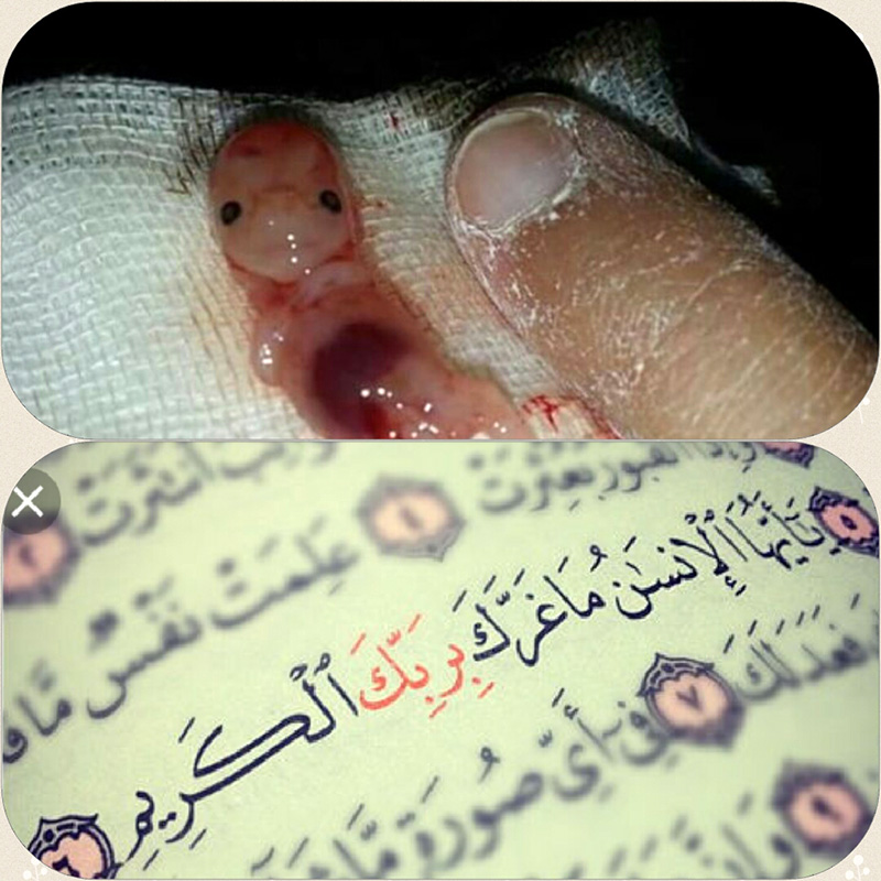 يا أَيُّهَا الْإِنْسانُ ما غَرَّکَ بِرَبِّکَ الْکَريمِ