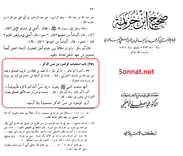 جسارت عمر در حدیث قرطاس